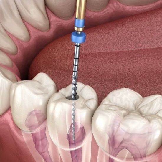 India's Best Dentist Landing Page 6